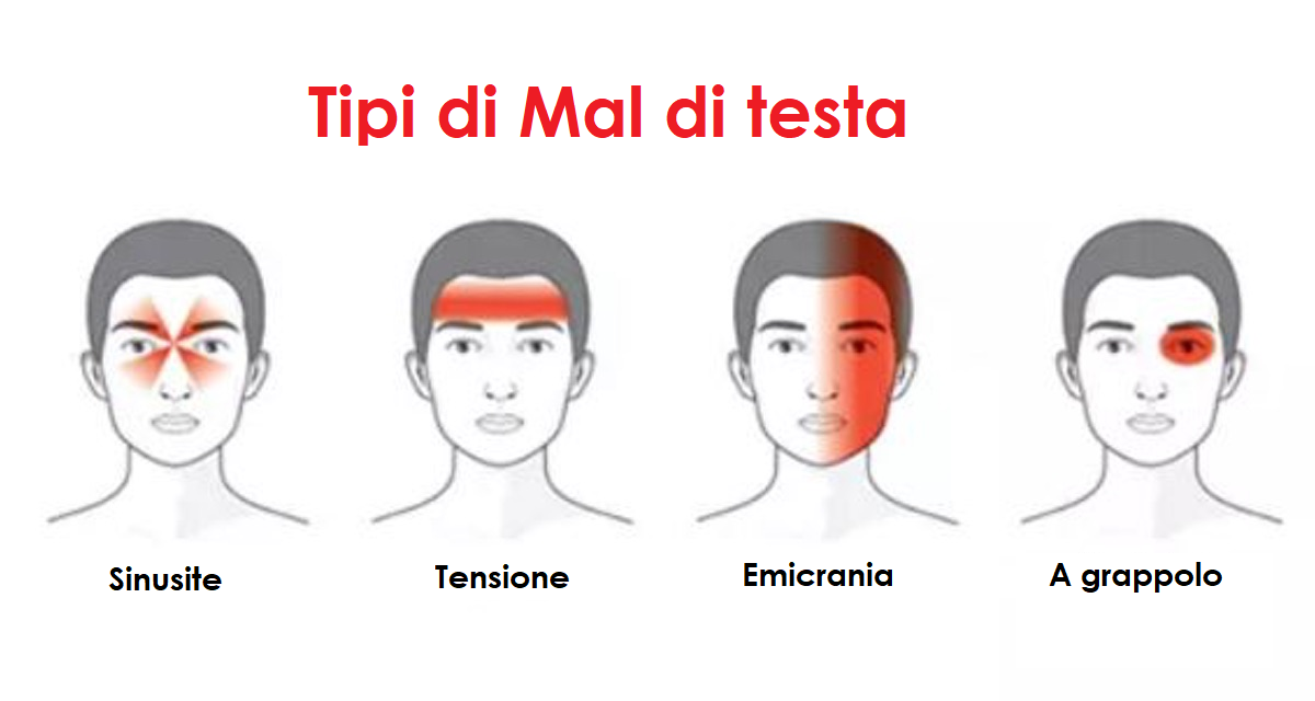 Tipologie di mal di testa